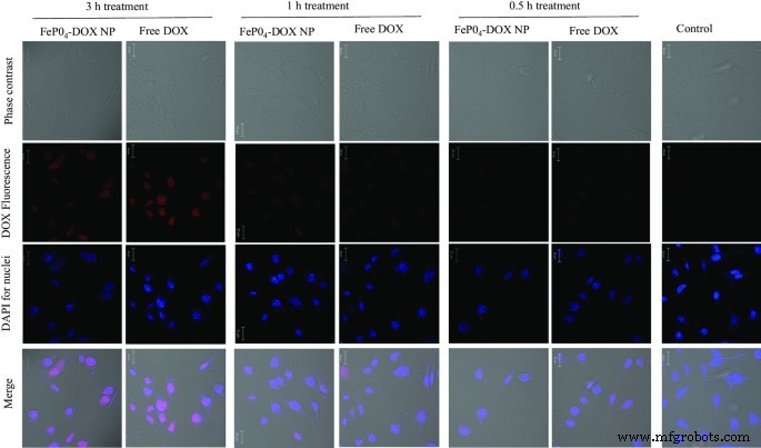 FePO₄ 나노입자: 독소루비신 전달, RNA 안정화, 향상된 항암 활성을 위한 생체적합성 캐리어