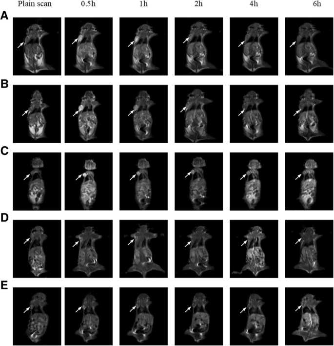αvβ3 인테그린과 NRP-1 이중 표적 파라자성 리포좀: 조기 종양 탐지를 위한 강력한 MRI 도구